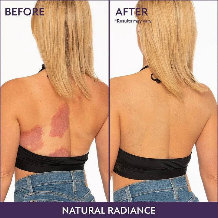 ✨ Body Coverage Perfector – Waterproof, lightweight & flawless body makeup