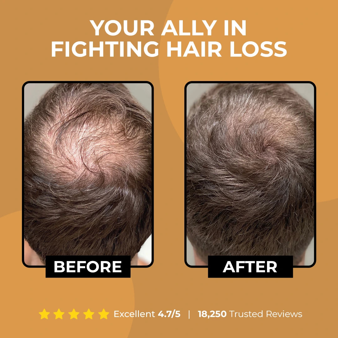 ✨Hair Profile Matched: Here is Your Hair Growth Plan