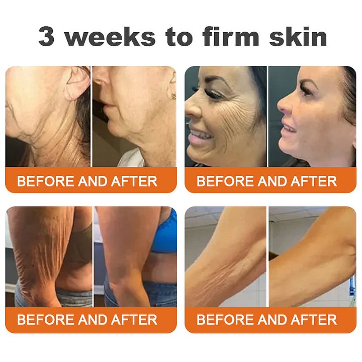Botox Bee Venom All-in-one Treatment Creamđâ¨