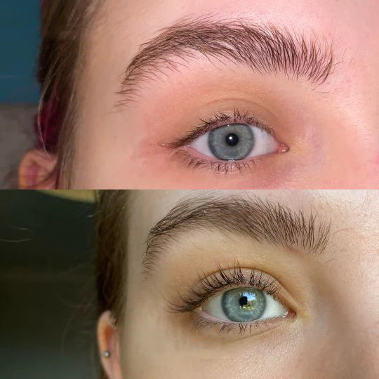 đ„Eyelash Active Serum For Longer & Fuller Lashes