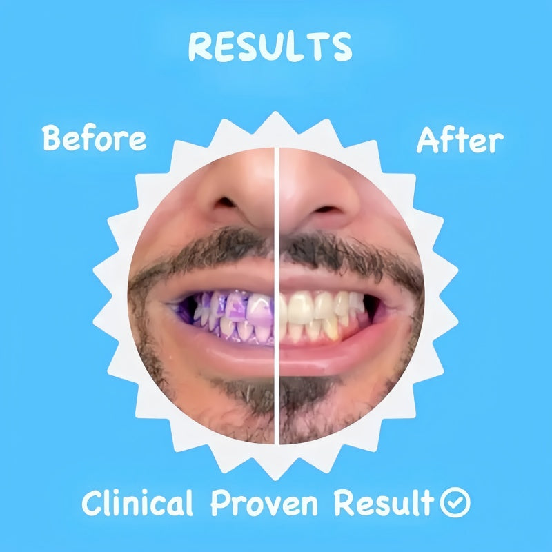 U-Shaped 360º Ultrasonic Toothbrush