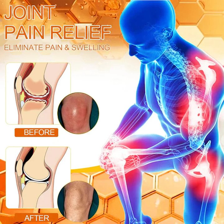 Bee-Venom Pain-Relief Bone Healing Cream🐝✨