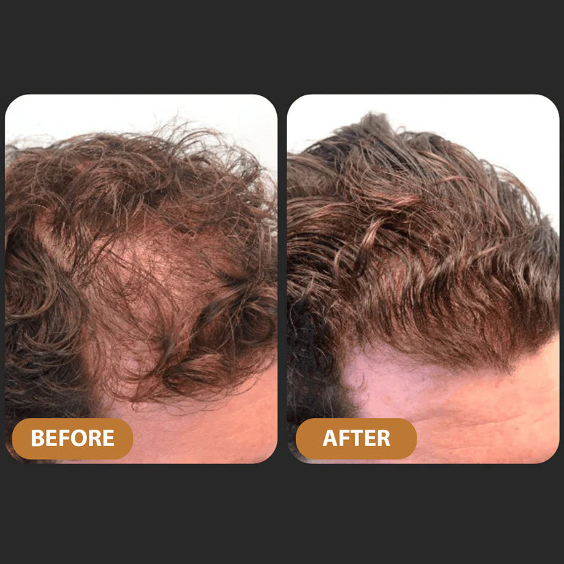 🌿Hair Profile Matched: Here is Your Hair Growth Plan