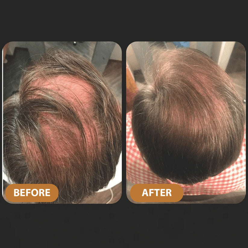 🌿Hair Profile Matched: Here is Your Hair Growth Plan