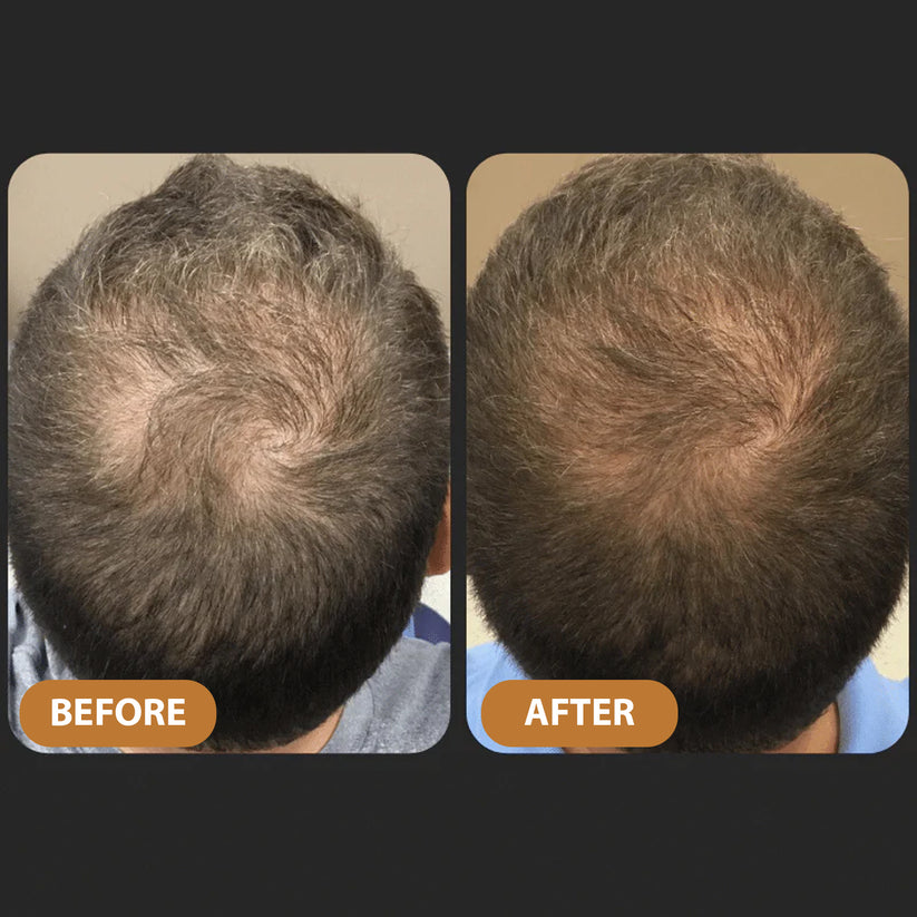 🌿Hair Profile Matched: Here is Your Hair Growth Plan