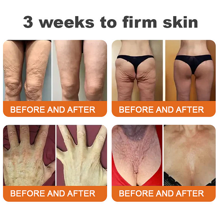 Botox Bee Venom All-in-one Treatment Creamđâ¨