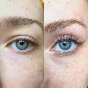 đ„Eyelash Active Serum For Longer & Fuller Lashes
