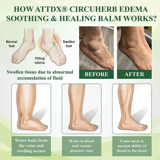 LANISKA CircuHerb Edema Soothing & Healing Balm🌿✨