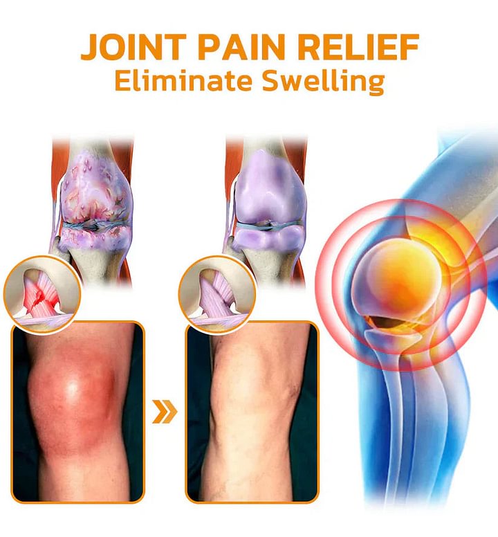 Bee-Venom Pain-Relief Bone Healing Cream🐝✨