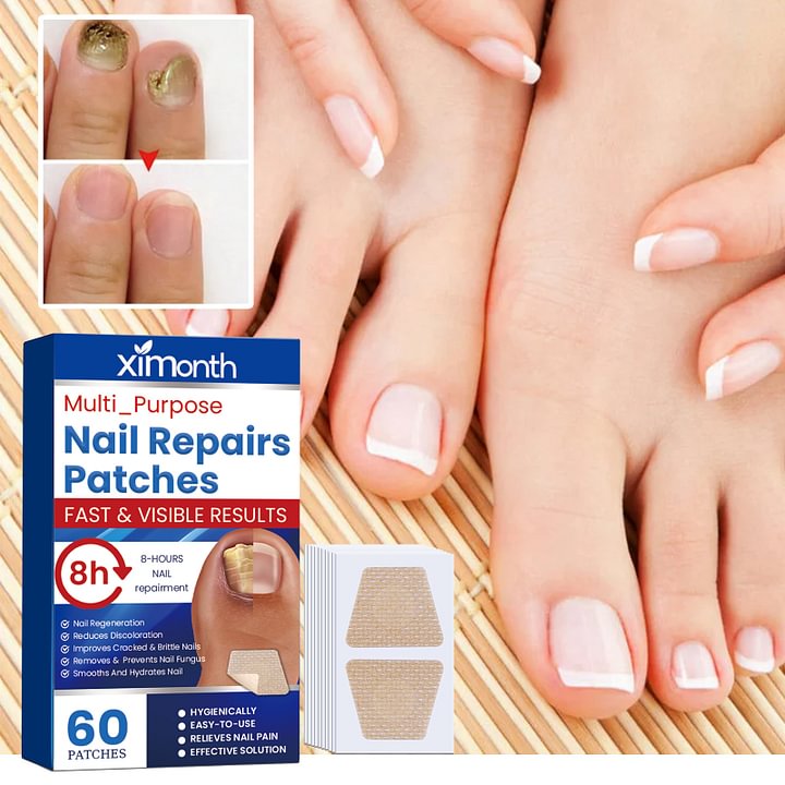Ximonth® Onychomycosis Repair Patch✨🌿