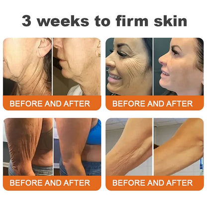 Botox Bee Venom All-in-one Treatment Cream🐝✨