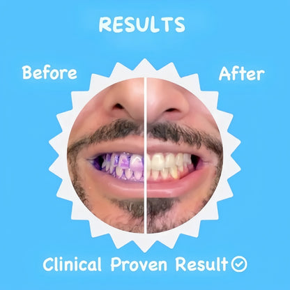 U-Shaped 360º Ultrasonic Toothbrush