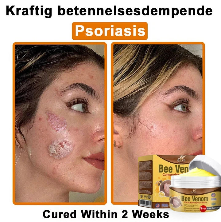 Bee Venom Comprehensive Cream🐝✨