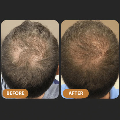 🌿Hair Profile Matched: Here is Your Hair Growth Plan