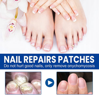 Ximonth® Onychomycosis Repair Patch✨🌿